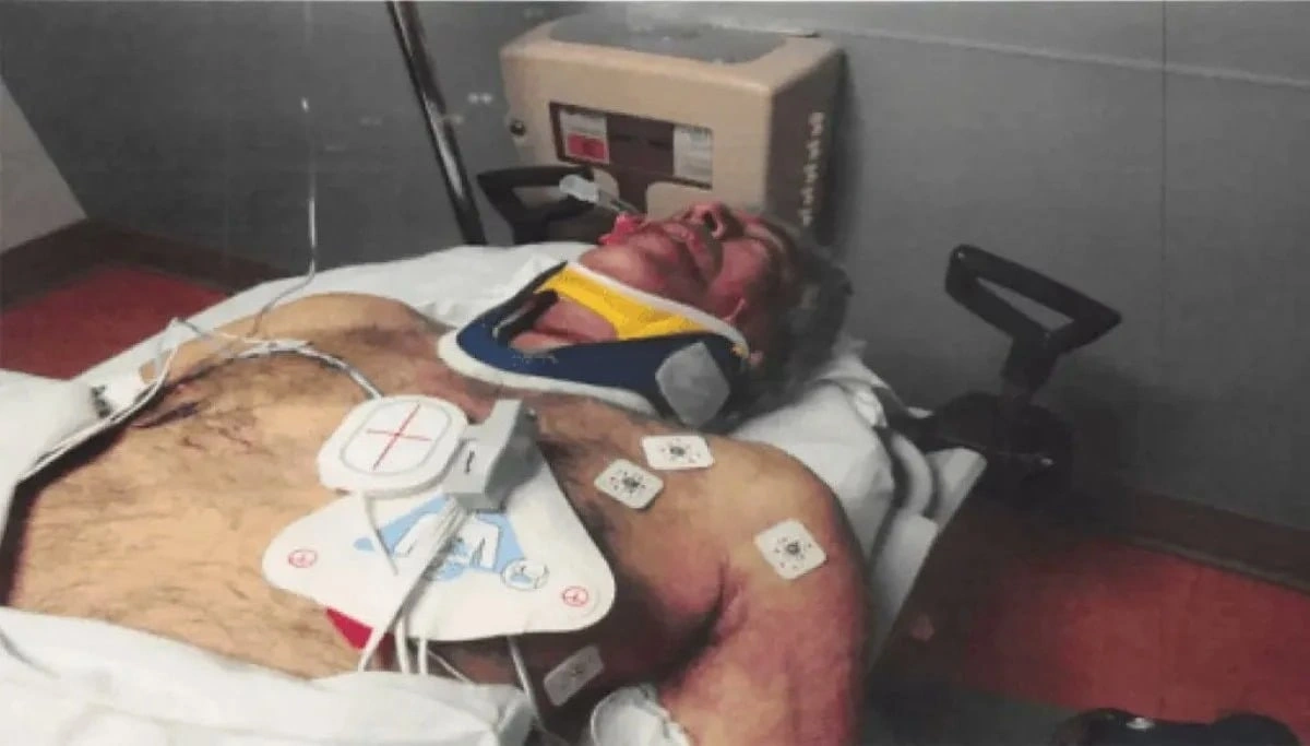 Epşteynin intihardan sonrakı görüntüləri yayımlandı - FOTO