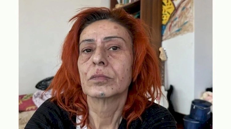 Yıldız Tilbənin reaksiyası gündəm oldu: Bitən 60 ilin...