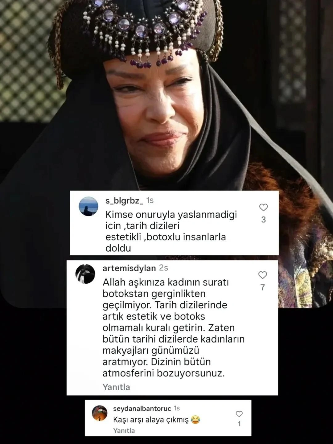 “Sara xatun”un botoksları müzakirə yaratdı - FOTO