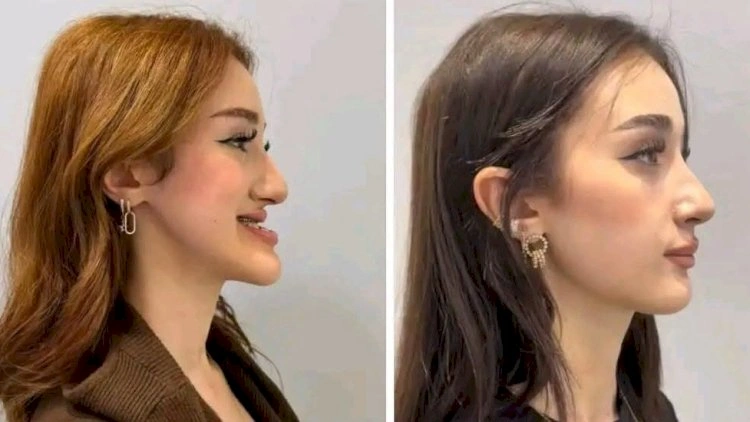 Azərbaycanlı həkimin əməliyyatı viral oldu - Sosial şəbəkələrdə hamı bundan danışır -   VİDEO