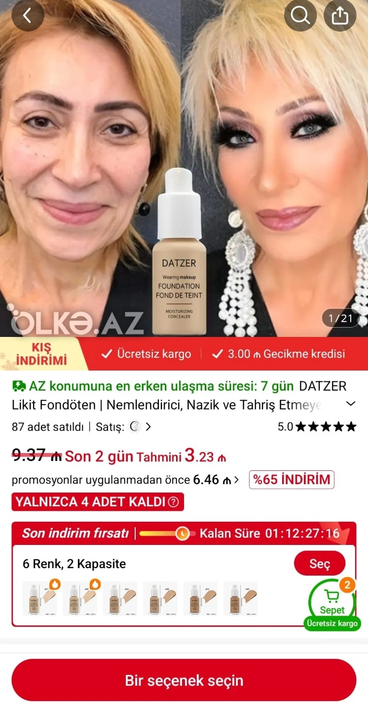 “Temu” Əməkdar artistlə bağlı açıqlama verdi