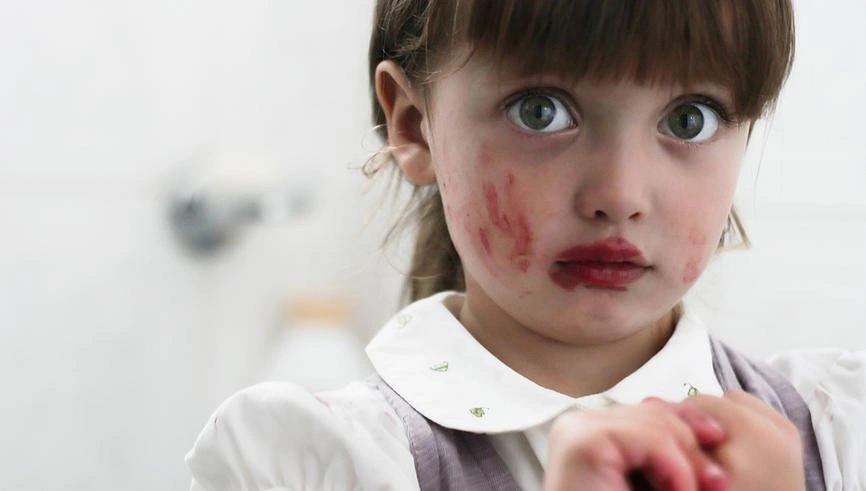 Dermatoloq xəbərdarlıq edir: Bu vasitələr uşaqlar üçün risklidir