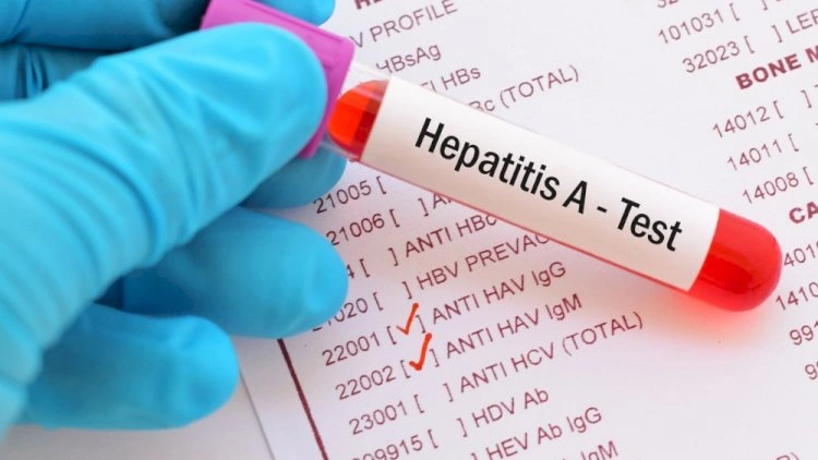 Azərbaycanda virus hepatiti ilə bağlı son statistika açıqlandı