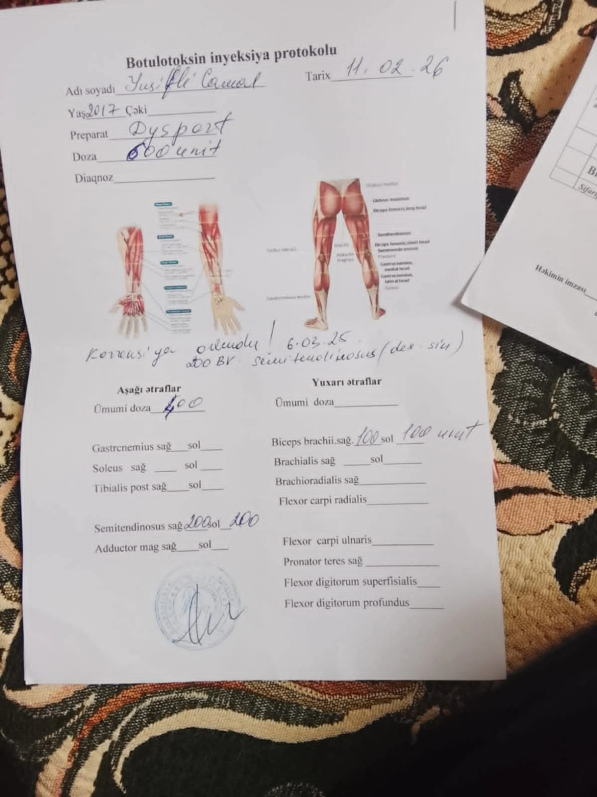 Balaca Camalın dəstəyə ehtiyacı var - Vəziyyəti ağırdır...