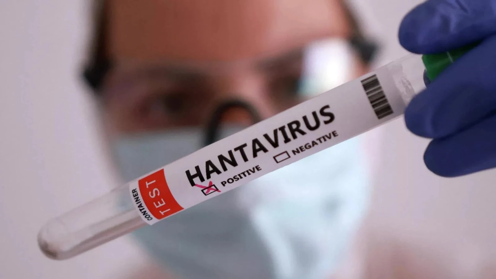 Fransada ilk hantavirus infeksiyası hadisəsi təsdiqləndi