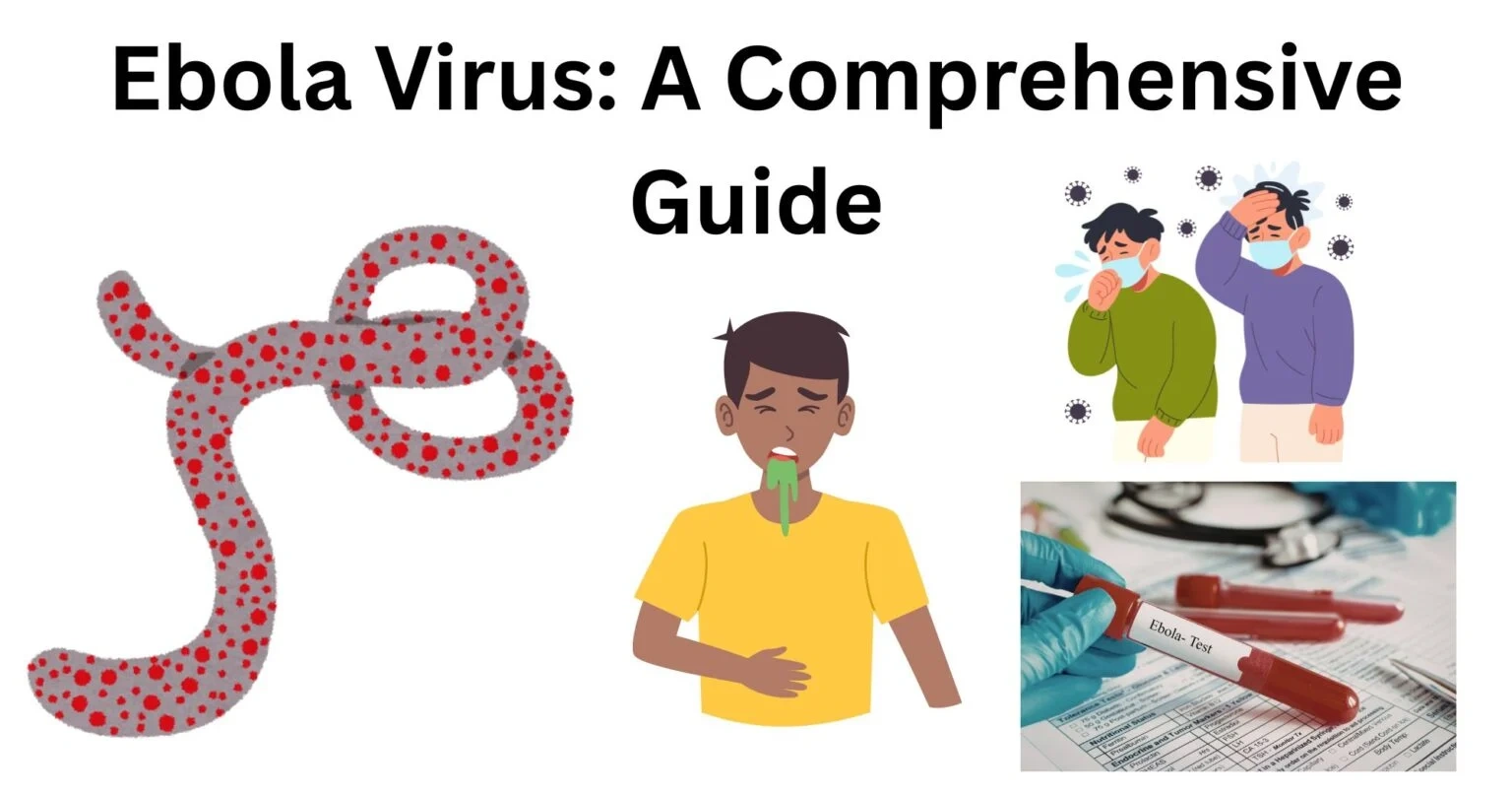 Dünyanı qorxudan Ebola kabusu: Pandemiya riski nə dərəcədə realdır?